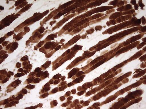Immunohistochemical staining of paraffin-embedded Human musue using anti-TNNT2 mouse monoclonal antibody. Heat-induced epitope retrieval by EDTA solution buffer pH 8.0 at 120Â°C for 3 min.