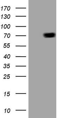 Western Blot Alas1 Antibody (OTI5D5)
