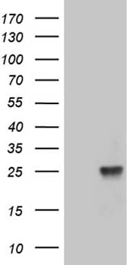 HEK293T cells were transfected with the pCMV6-ENTRY control ( Left lane) or pCMV6-ENTRY TEX30 ( Right lane) cDNA for 48 hrs and lysed. Equivalent amounts of cell lysates (5 ug per lane) were separated by SDS-PAGE and immunoblotted with anti-TEX30 (1:500). Positive lysates