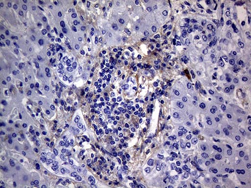 Immunohistochemistry PMP22 Antibody (OTI5D1)