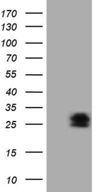 Western Blot:PMP22 Antibody (OTI5D1)[NBP3-44912]