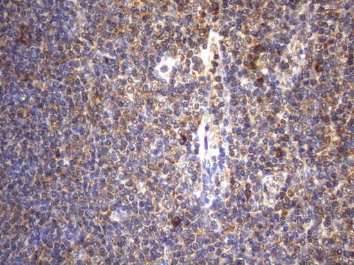 Immunohistochemical staining of paraffin-embedded Human tonsil within the normal limits using anti-CYTH2 mouse monoclonal antibody. Heat-induced epitope retrieval by EDTA solution buffer pH 8.0 at 120Â°C for 3 min.
