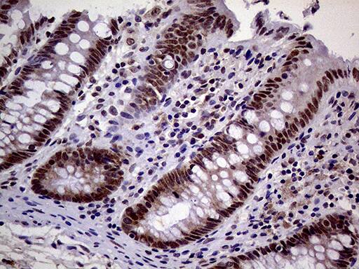 Immunohistochemical staining of paraffin-embedded Human colon tissue within the normal limits using anti-MAGEB4 mouse monoclonal antibody. Heat-induced epitope retrieval by EDTA solution buffer pH 8.0 at 120Â°C for 3 min.