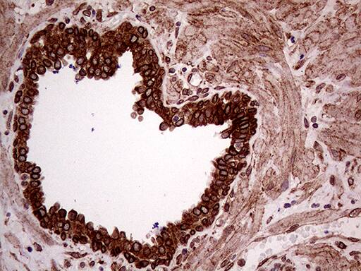 Immunohistochemical staining of paraffin-embedded Human prostate tissue within the normal limits using anti-ERLIN1 mouse monoclonal antibody. Heat-induced epitope retrieval by EDTA solution buffer pH 8.0 at 120Â°C for 3 min.