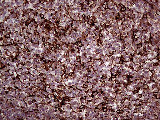 Immunohistochemical staining of paraffin-embedded Human lymph node tissue within the normal limits using anti-ERLIN1 mouse monoclonal antibody. Heat-induced epitope retrieval by EDTA solution buffer pH 8.0 at 120Â°C for 3 min.