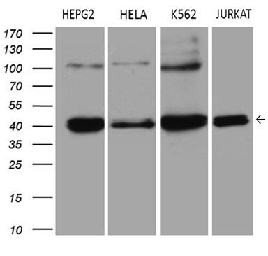 Western blot analysis of extracts (35ug) from 4 different cell lines by using anti-ERLIN1 monoclonal antibody (1:500).