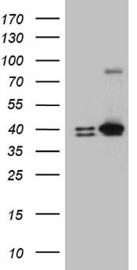 HEK293T cells were transfected with the pCMV6-ENTRY control ( Left lane) or pCMV6-ENTRY ERLIN1 ( Right lane) cDNA for 48 hrs and lysed. Equivalent amounts of cell lysates (5 ug per lane) were separated by SDS-PAGE and immunoblotted with anti-ERLIN1 (1:2000). Positive lysates