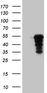 HEK293T cells were transfected with the pCMV6-ENTRY control ( Left lane) or pCMV6-ENTRY MAGEB4 ( Right lane) cDNA for 48 hrs and lysed. Equivalent amounts of cell lysates (5 ug per lane) were separated by SDS-PAGE and immunoblotted with anti-MAGEB4 (1:2000). Positive lysates