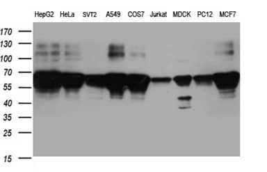 Western blot analysis of extracts (35ug) from 9 different cell lines by using anti-BNIPL monoclonal antibody (1:500).