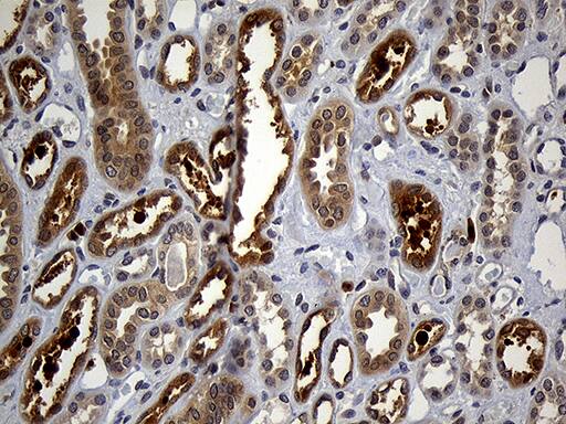 Immunohistochemical staining of paraffin-embedded Human Kidney tissue within the normal limits using anti-GRB7 mouse monoclonal antibody. Heat-induced epitope retrieval by EDTA solution buffer pH 8.0 at 120Â°C for 3 min.