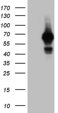 HEK293T cells were transfected with the pCMV6-ENTRY control (Left lane) or pCMV6-ENTRY GRB7 (, Right lane) cDNA for 48 hrs and lysed. Equivalent amounts of cell lysates (5 ug per lane) were separated by SDS-PAGE and immunoblotted with anti-GRB7 (1:2000). 