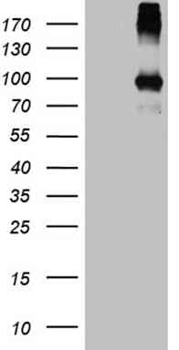 HEK293T cells were transfected with the pCMV6-ENTRY control ( Left lane) or pCMV6-ENTRY PAMR1 ( Right lane) cDNA for 48 hrs and lysed. Equivalent amounts of cell lysates (5 ug per lane) were separated by SDS-PAGE and immunoblotted with anti-PAMR1 (1:500).