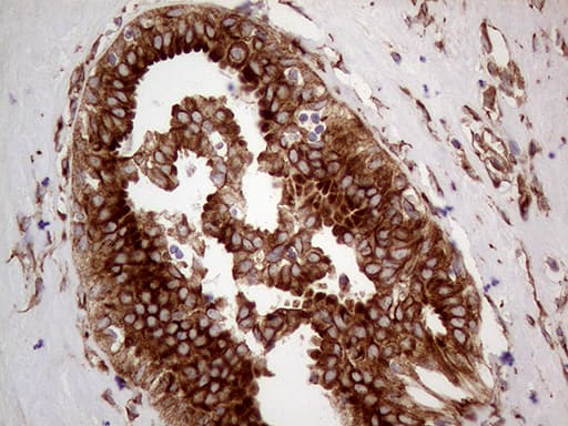 Immunohistochemistry:HABP2 Antibody (OTI8D6)[NBP3-44933]