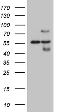 Western Blot HABP2 Antibody (OTI8D6)