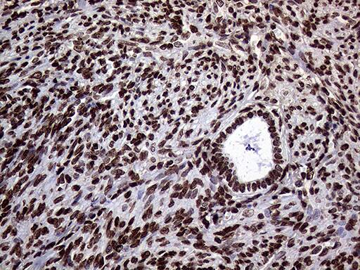 Immunohistochemical staining of paraffin-embedded Human endometrium tissue within the normal limits using anti-TRMT5 mouse monoclonal antibody. Heat-induced epitope retrieval by EDTA solution buffer pH 8.0 at 120Â°C for 3 min.
