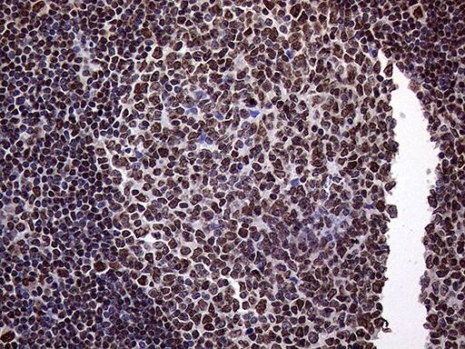 Immunohistochemical staining of paraffin-embedded Human tonsil within the normal limits using anti-TRMT5 mouse monoclonal antibody. Heat-induced epitope retrieval by EDTA solution buffer pH 8.0 at 120Â°C for 3 min.