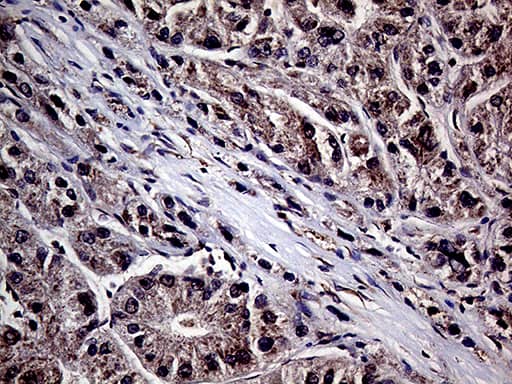 Immunohistochemistry:HABP2 Antibody (OTI5H3)[NBP3-44939]