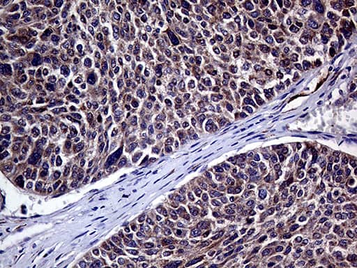 Immunohistochemistry:HABP2 Antibody (OTI5H3)[NBP3-44939]