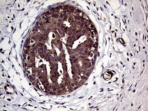 Immunohistochemistry HABP2 Antibody (OTI5H3)