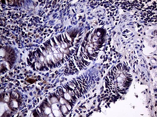 Immunohistochemical staining of paraffin-embedded Human colon tissue within the normal limits using anti-HABP2 mouse monoclonal antibody. Heat-induced epitope retrieval by EDTA solution buffer pH 8.0 at 120Â°C for 3 min.