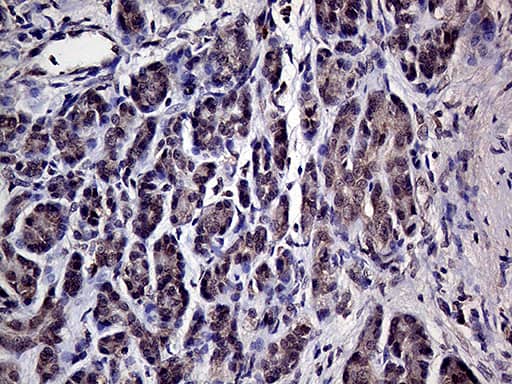Immunohistochemical staining of paraffin-embedded Human pancreas tissue within the normal limits using anti-HABP2 mouse monoclonal antibody. Heat-induced epitope retrieval by EDTA solution buffer pH 8.0 at 120Â°C for 3 min.