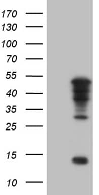 HEK293T cells were transfected with the pCMV6-ENTRY control ( Left lane) or pCMV6-ENTRY TBX20 ( Right lane) cDNA for 48 hrs and lysed. Equivalent amounts of cell lysates (5 ug per lane) were separated by SDS-PAGE and immunoblotted with anti-TBX20 (1:2000). Positive lysates