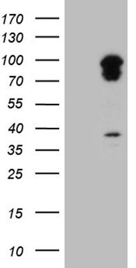 HEK293T cells were transfected with the pCMV6-ENTRY control ( Left lane) or pCMV6-ENTRY TRAFD1 ( Right lane) cDNA for 48 hrs and lysed. Equivalent amounts of cell lysates (5 ug per lane) were separated by SDS-PAGE and immunoblotted with anti-TRAFD1 (1:2000). Positive lysates