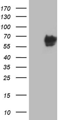 Western Blot CACNB1 Antibody (OTI3H6)