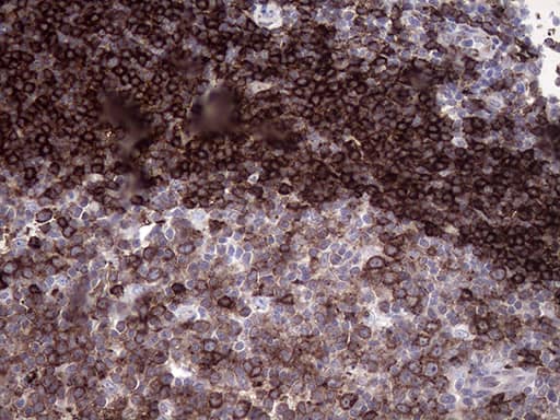 Immunohistochemical staining of paraffin-embedded Human lymph node tissue within the normal limits using anti-RAB23 mouse monoclonal antibody. Heat-induced epitope retrieval by EDTA solution buffer pH 8.0 at 120Â°C for 3 min.