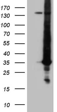 HEK293T cells were transfected with the pCMV6-ENTRY control ( Left lane) or pCMV6-ENTRY RAB23 ( Right lane) cDNA for 48 hrs and lysed. Equivalent amounts of cell lysates (5 ug per lane) were separated by SDS-PAGE and immunoblotted with anti-RAB23 (1:2000). Positive lysates