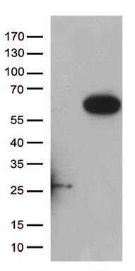 HEK293T cells were transfected with the pCMV6-ENTRY control ( Left lane) or pCMV6-ENTRY RASSF9 ( Right lane) cDNA for 48 hrs and lysed. Equivalent amounts of cell lysates (5 ug per lane) were separated by SDS-PAGE and immunoblotted with anti-RASSF9 (1:500). Positive lysates