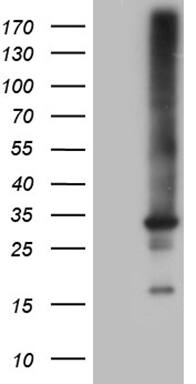 Western Blot:RAB23 Antibody (OTI4C7)[NBP3-44949]