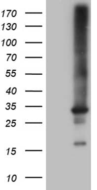 HEK293T cells were transfected with the pCMV6-ENTRY control (Left lane) or pCMV6-ENTRY RAB23 (, Right lane) cDNA for 48 hrs and lysed. Equivalent amounts of cell lysates (5 ug per lane) were separated by SDS-PAGE and immunoblotted with anti-RAB23 (1:2000). 