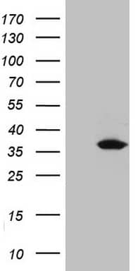 Western Blot UCK2 Antibody (OTI21A6)