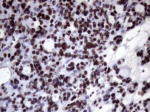 Immunohistochemistry:XRN2 Antibody (OTI5F4)[NBP3-44953]