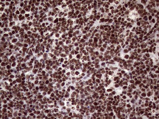 Immunohistochemistry:XRN2 Antibody (OTI5F4)[NBP3-44953]