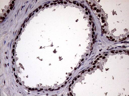 Immunohistochemistry XRN2 Antibody (OTI5F4)