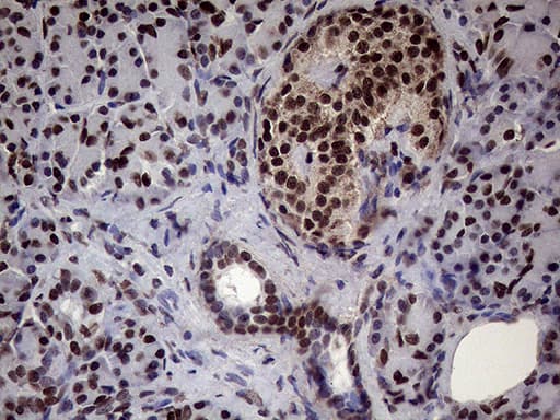 Immunohistochemistry XRN2 Antibody (OTI5F4)