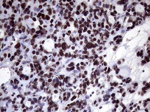 Immunohistochemistry XRN2 Antibody (OTI5F4)