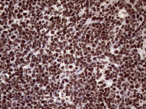 Immunohistochemistry XRN2 Antibody (OTI5F4)