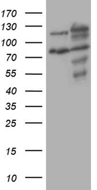 Western Blot:XRN2 Antibody (OTI5F4)[NBP3-44953]