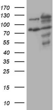 Western Blot XRN2 Antibody (OTI5F4)
