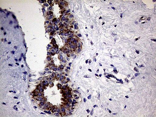 Immunohistochemistry:CLIP4 Antibody (OTI5D10)[NBP3-44957]