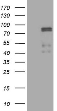 Western Blot:CLIP4 Antibody (OTI5D10)[NBP3-44957]