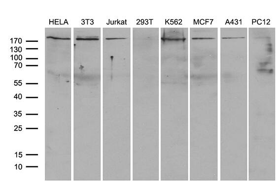 Western blot analysis of extracts (35ug) from 8 different cell lines by using anti-ARHGAP5 monoclonal antibody (1:500).