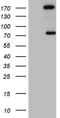 Western Blot RhoGAP Antibody (OTI9H2)
