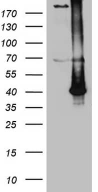 HEK293T cells were transfected with the pCMV6-ENTRY control ( Left lane) or pCMV6-ENTRY ASB13 ( Right lane) cDNA for 48 hrs and lysed. Equivalent amounts of cell lysates (5 ug per lane) were separated by SDS-PAGE and immunoblotted with anti-ASB13 (1:2000). Positive lysates