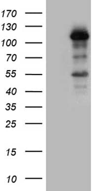 HEK293T cells were transfected with the pCMV6-ENTRY control ( Left lane) or pCMV6-ENTRY LONRF3 ( Right lane) cDNA for 48 hrs and lysed. Equivalent amounts of cell lysates (5 ug per lane) were separated by SDS-PAGE and immunoblotted with anti-LONRF3 (1:500). Positive lysates