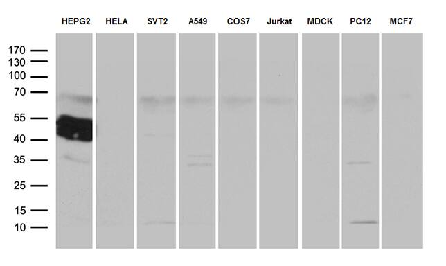 Western Blot ZCCHC17 Antibody (OTI1F11)