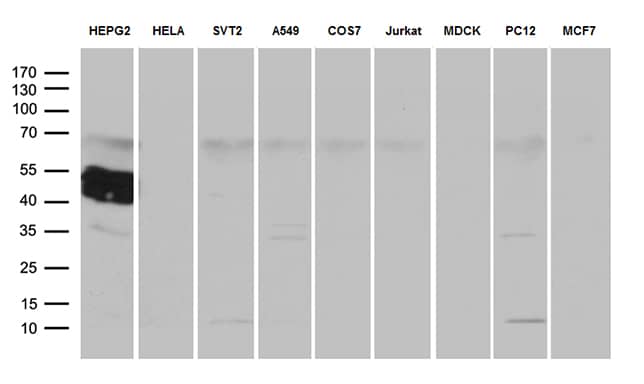Western blot analysis of extracts (35ug) from 9 different cell lines by using anti-ZCCHC17 monoclonal antibody (1:500).